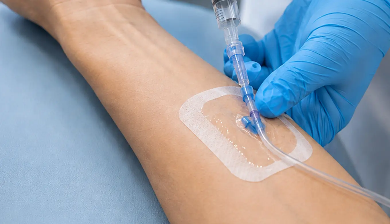 Terapia Endovenosa